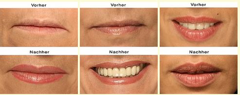 lippenkonturen mit permanent makeup